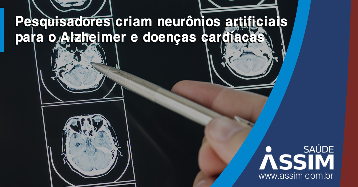 Pesquisadores ingleses criam neurnios artificiais para tratamento do Alzheimer e de doenas cardacas
