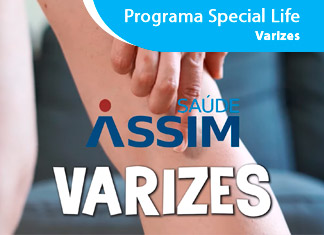 Programa Special Life - Varizes